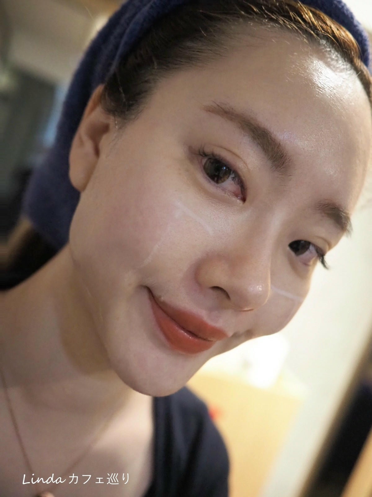 高雄綻美時尚醫美診所 音波拉提 緊緻小臉015.jpg 高雄綻美時尚醫美診所 音波拉提 緊緻小臉015.jpg