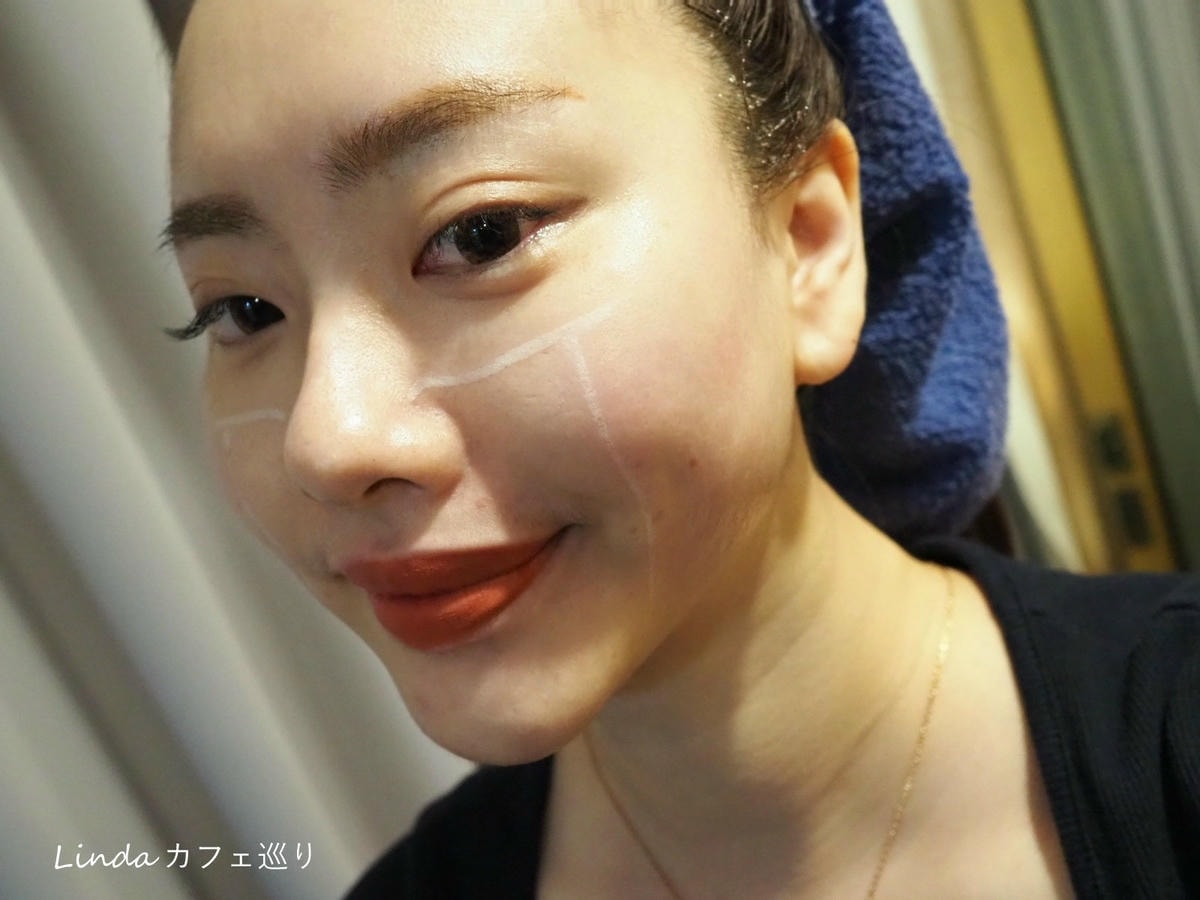 高雄綻美時尚醫美診所 音波拉提 緊緻小臉014.jpg 高雄綻美時尚醫美診所 音波拉提 緊緻小臉014.jpg