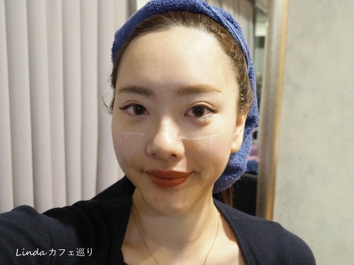 高雄綻美時尚醫美診所 音波拉提 緊緻小臉004.jpg 高雄綻美時尚醫美診所 音波拉提 緊緻小臉004.jpg