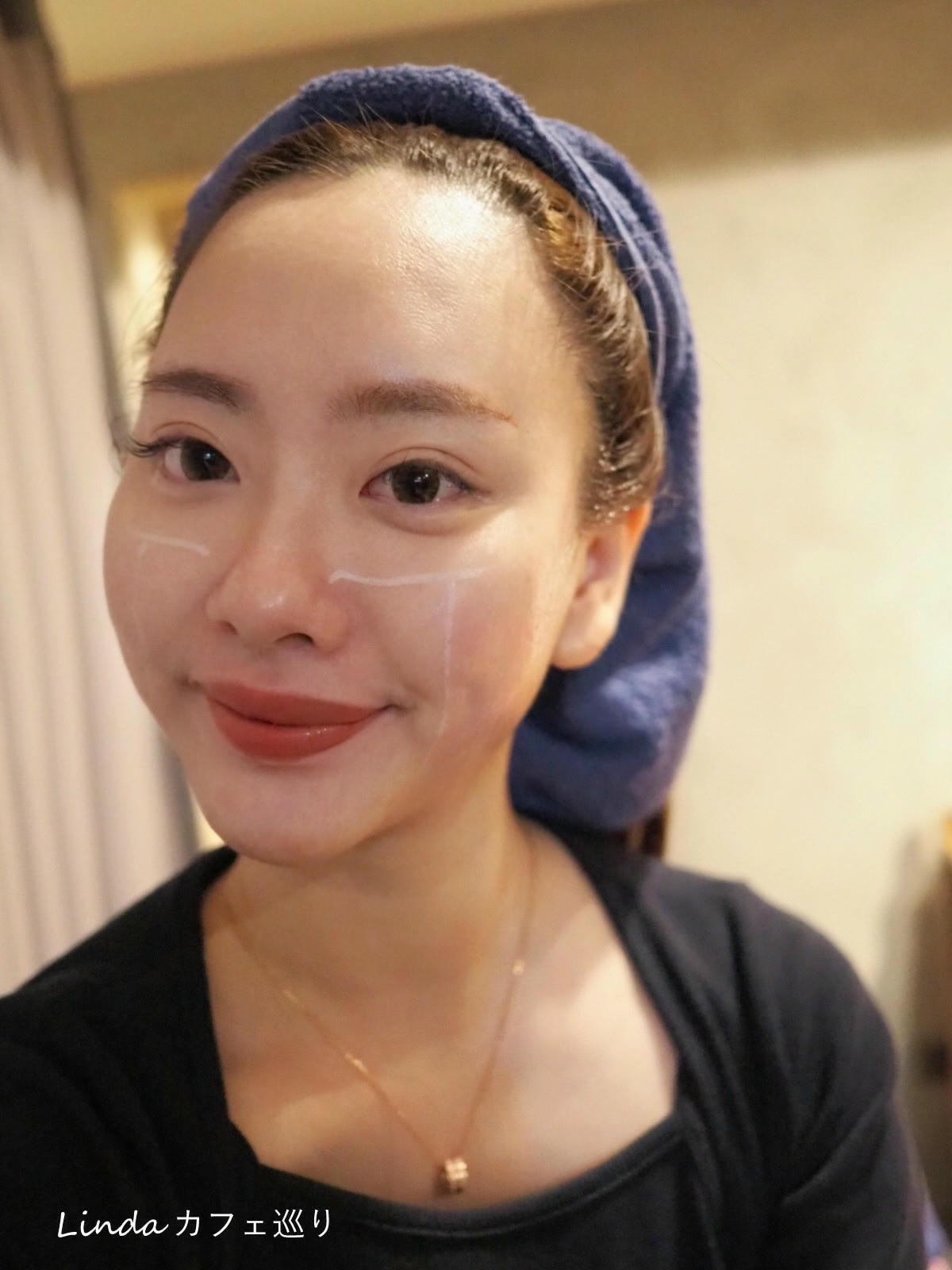 高雄綻美時尚醫美診所 音波拉提 緊緻小臉002.jpg 高雄綻美時尚醫美診所 音波拉提 緊緻小臉002.jpg