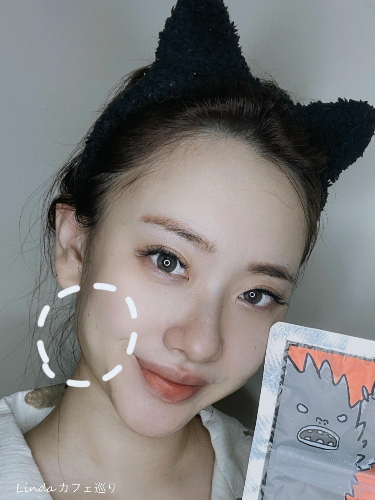 君綺醫美診所 肉毒小臉002.jpg 君綺醫美診所 肉毒小臉002.jpg