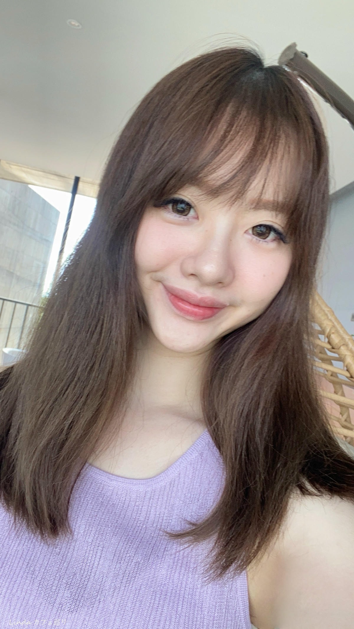 君綺醫美診所 肉毒小臉018.jpg 君綺醫美診所 肉毒小臉018.jpg