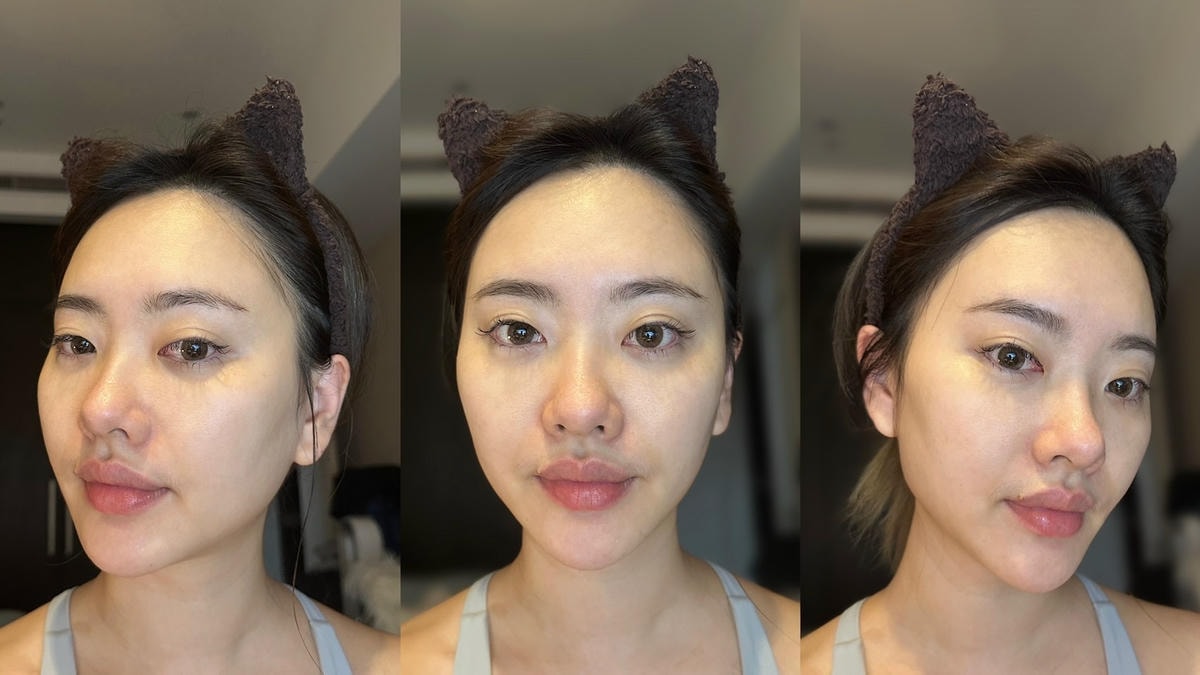 桃園淨妍診所氧氣玻尿酸施打心得,找回八字無痕的少女幼態感! 桃園淨妍診所氧氣玻尿酸施打心得,找回八字無痕的少女幼態感!