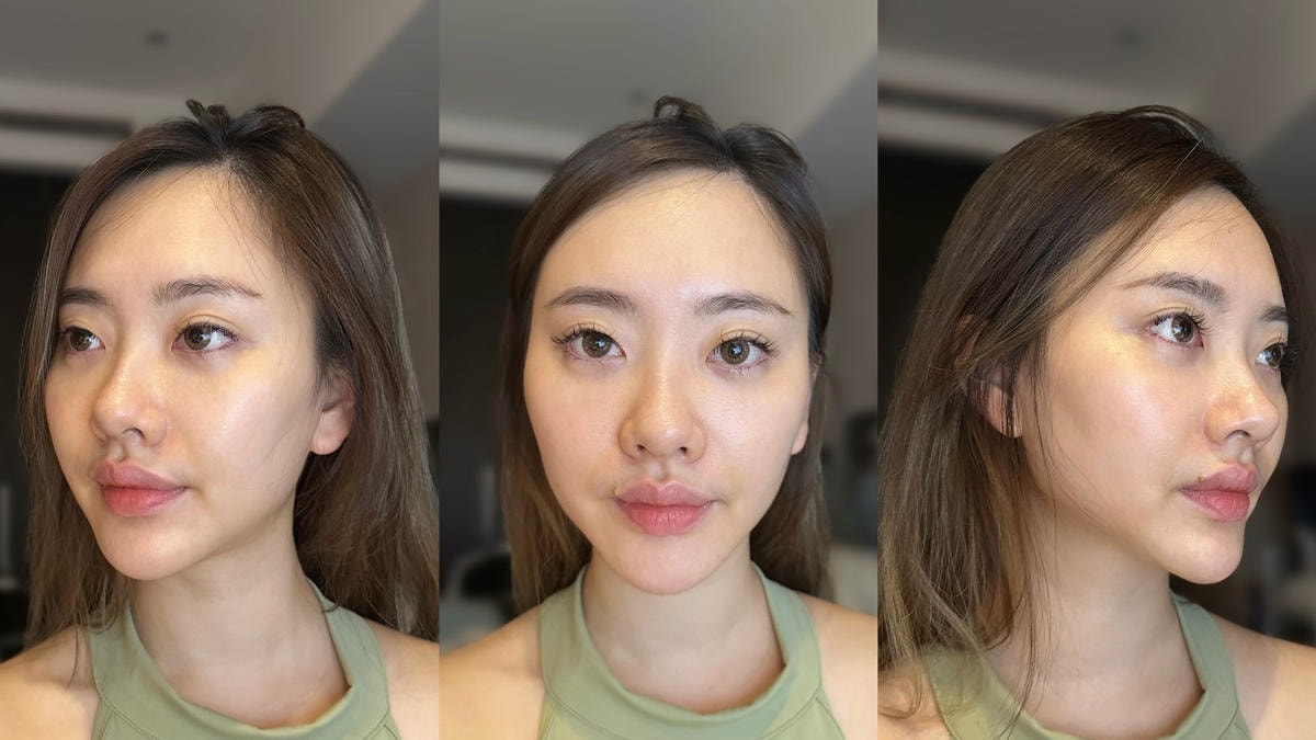 桃園淨妍診所氧氣玻尿酸施打心得,找回八字無痕的少女幼態感! 桃園淨妍診所氧氣玻尿酸施打心得,找回八字無痕的少女幼態感!