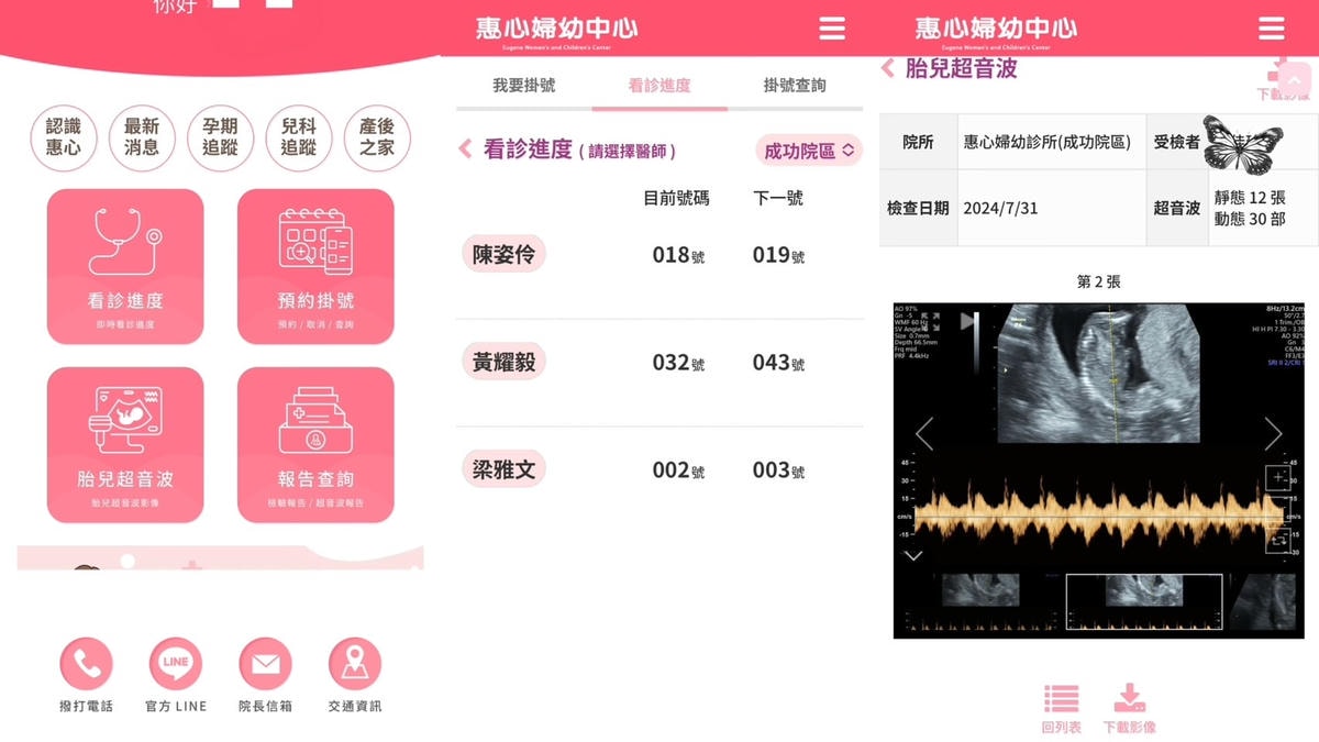 三重婦幼醫院推薦《惠心婦產科小兒科診所》例行產檢+乳房超音波