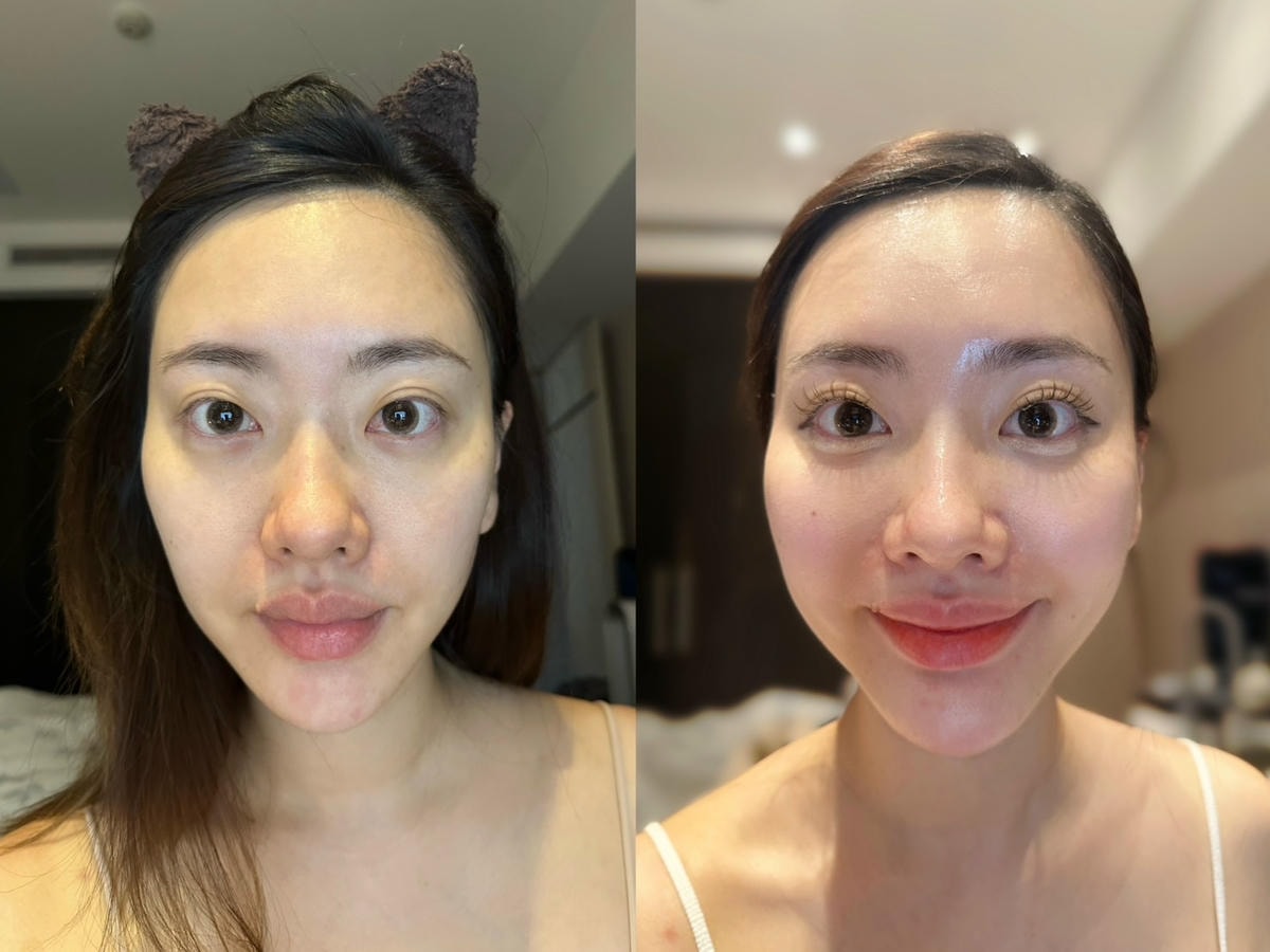 信義區水飛梭推薦《巧之妍美學診所》從肌膚檢測到深層清潔毛孔, 信義區水飛梭推薦《巧之妍美學診所》從肌膚檢測到深層清潔毛孔,