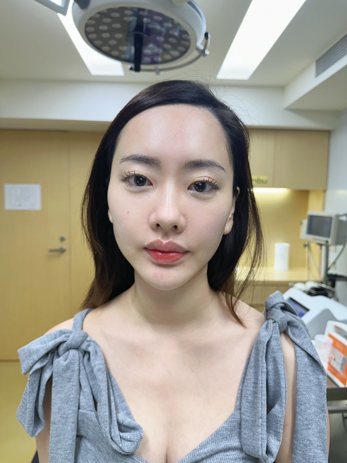 V SHOCK法國驚奇電音波《巴比侖診所》結合電波+音波的醫 V SHOCK法國驚奇電音波《巴比侖診所》結合電波+音波的醫