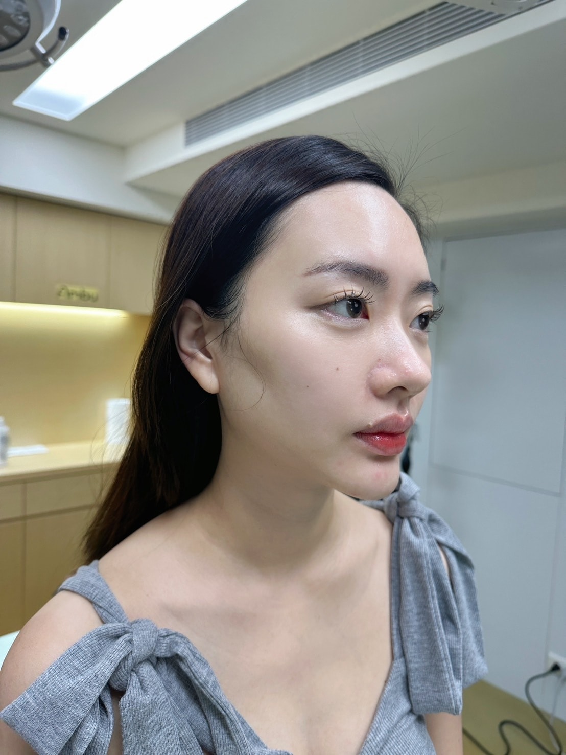 V SHOCK法國驚奇電音波《巴比侖診所》結合電波+音波的醫 V SHOCK法國驚奇電音波《巴比侖診所》結合電波+音波的醫
