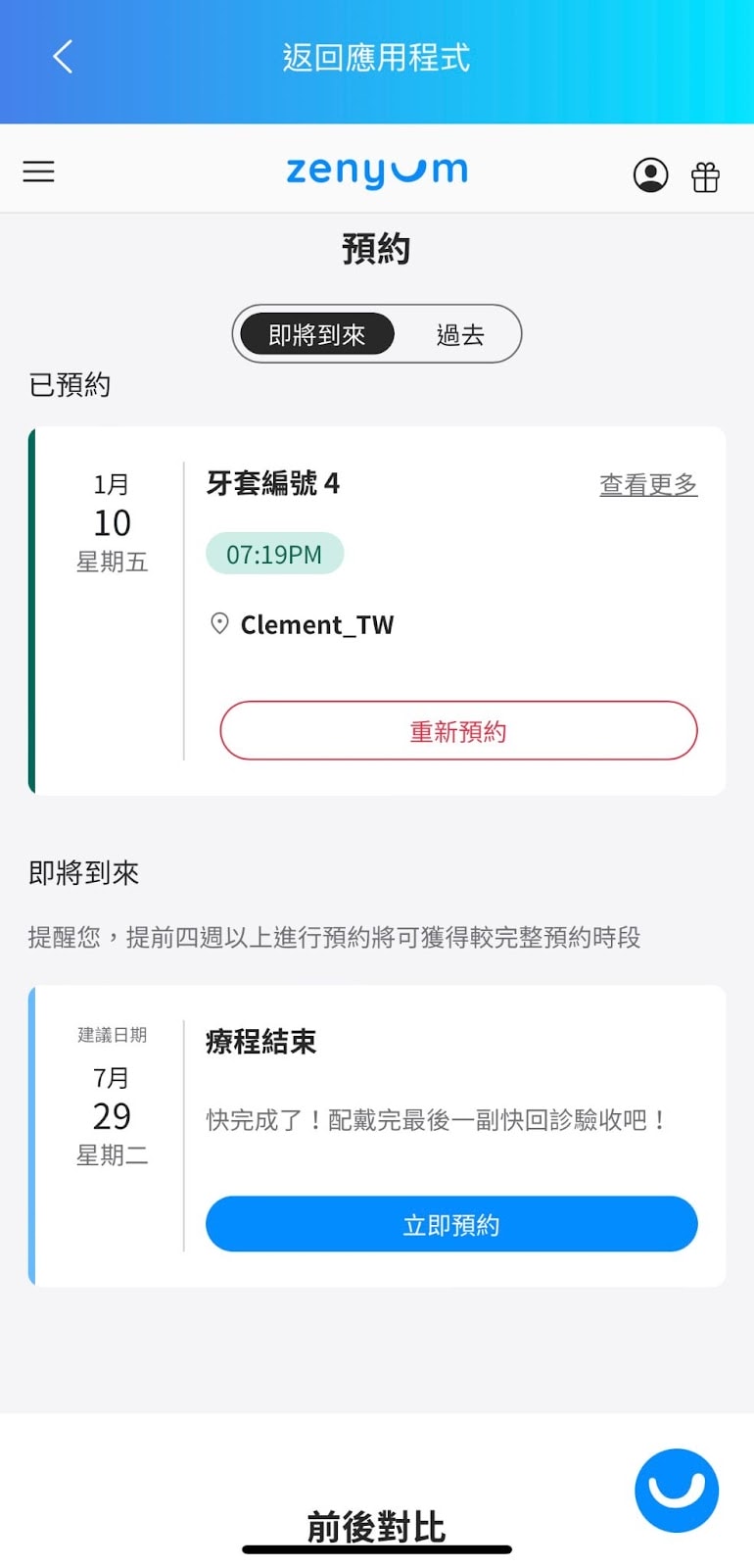 小資隱形牙套入門推薦「Zenyum 綻雅隱形牙套」價格均一價 小資隱形牙套入門推薦「Zenyum 綻雅隱形牙套」價格均一價