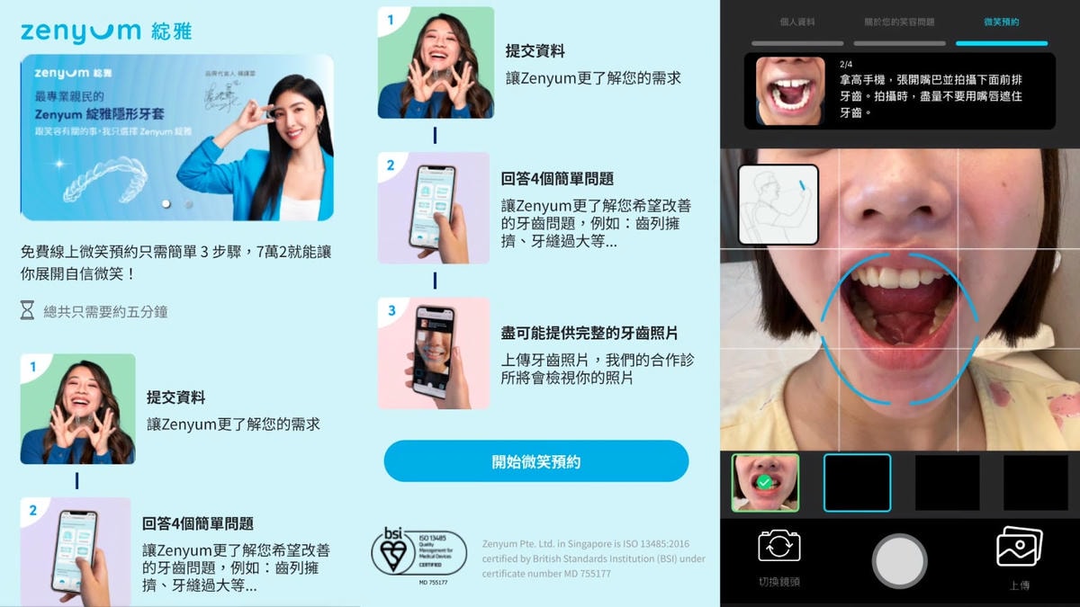 小資隱形牙套入門推薦「Zenyum 綻雅隱形牙套」價格均一價 小資隱形牙套入門推薦「Zenyum 綻雅隱形牙套」價格均一價